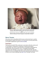 Myles Textbook for Midwives – 17th Edition